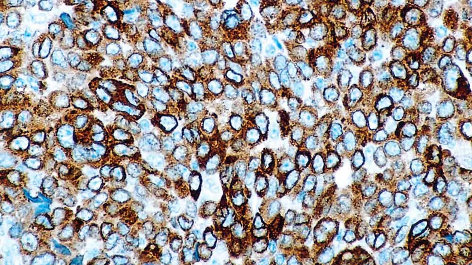 Melan A A103 PA0233