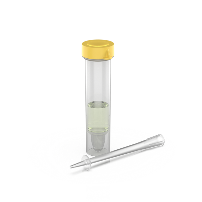 Urin Sediment